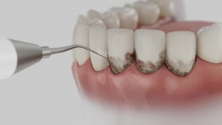 Reliable Dental contractor in Montpelier, OH by Dentist Open Now